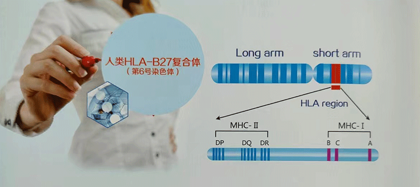 HLA-B27基因分型测定试剂盒（强直性脊柱炎检测）